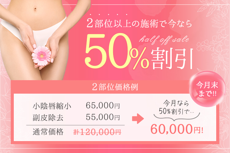 50%OFF
