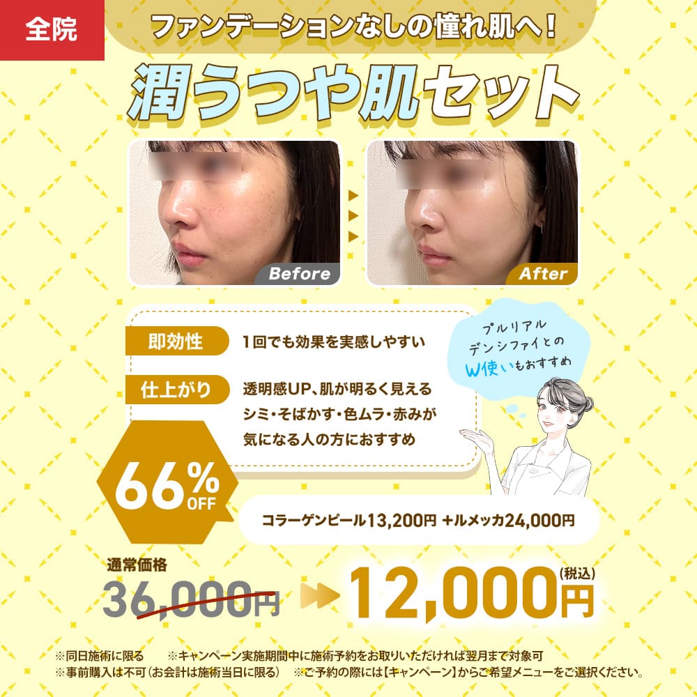 コラーゲンピール＋ルメッカキャンペーン