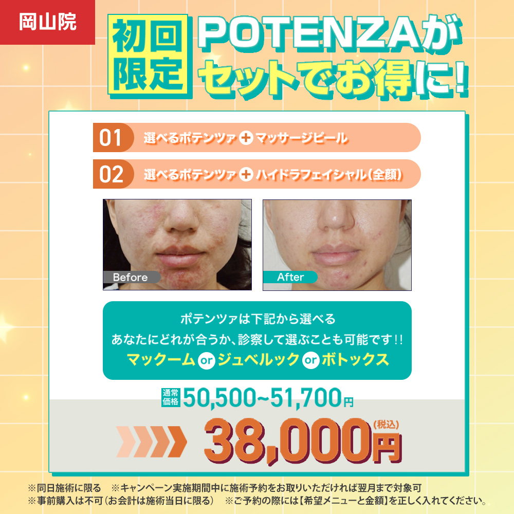 ポテンツァキャンペーン