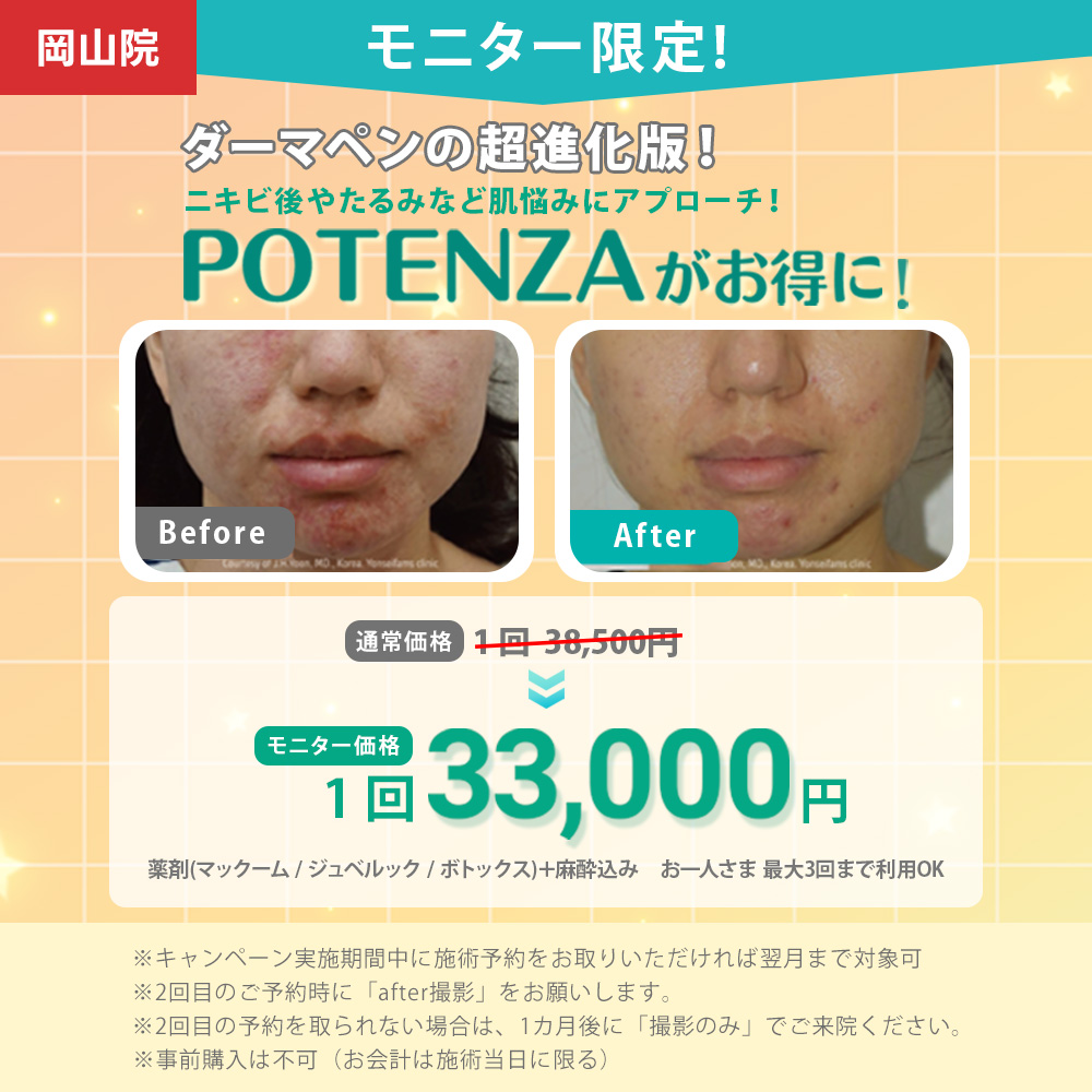 ポテンツァモニター