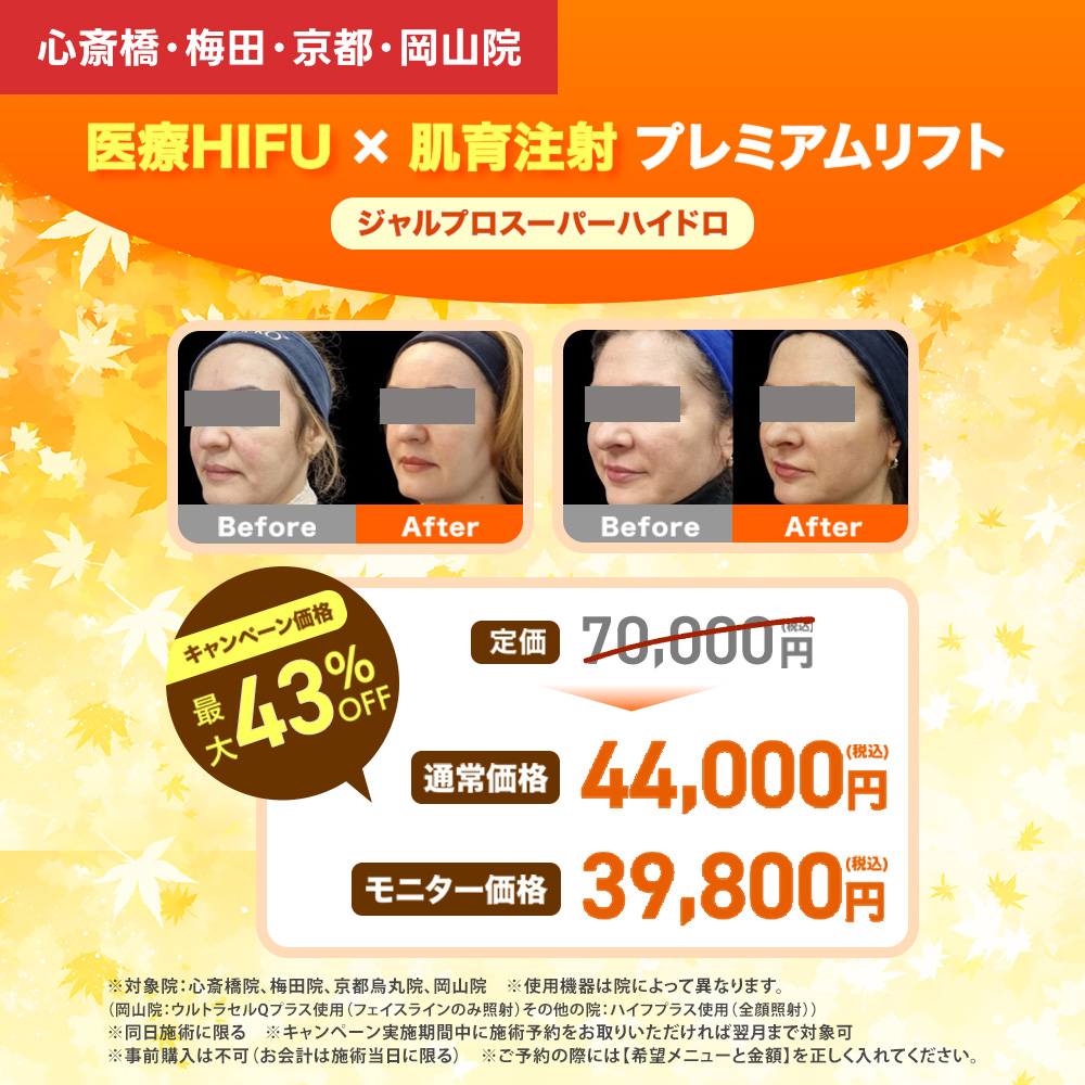 ジャルプロキャンペーン