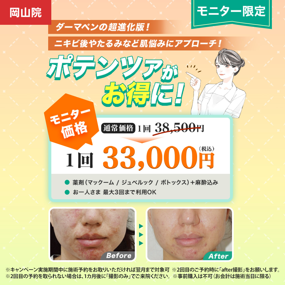 ポテンツァモニター