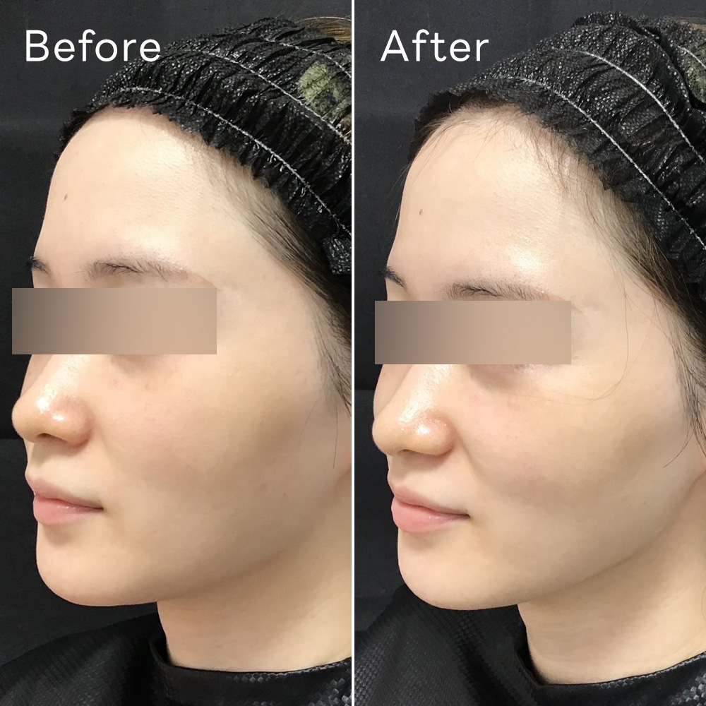 ララドクター症例